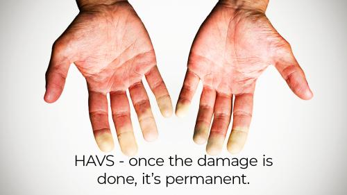 HAVS